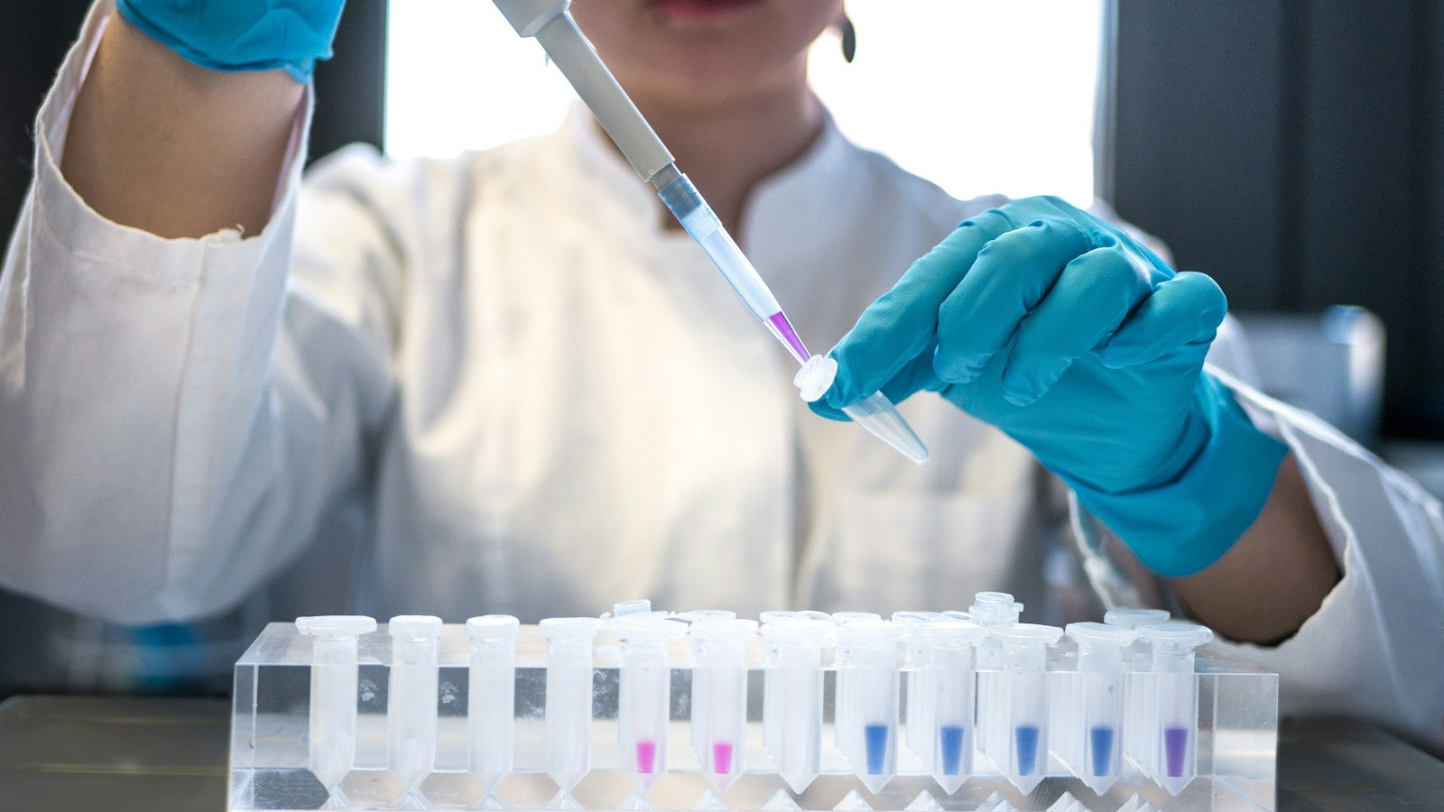 Patent Lawyer for Biotech | Schell IP | Schell IP: Premier Patent Law Support | Schell IP: Premier Patent Law Support Scientist using a pipette in a biotechnology laboratory